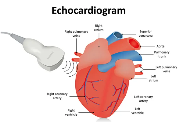 Echo